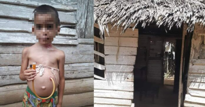 Recibe ayuda el niño de 4 años con grave condición de salud 