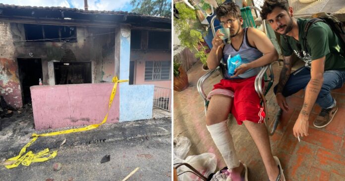 Piden ayuda para joven cubano que sobrevivió a incendio en La Habana