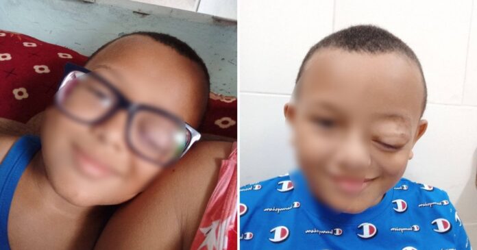 “Pido a gritos una visa humanitaria para mi hijo”: niño cubano con tumor en un ojo