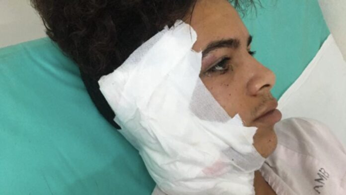 Adolescente trans sufre brutal agresión en Matanzas; piden al gobierno que tome cartas en el asunto