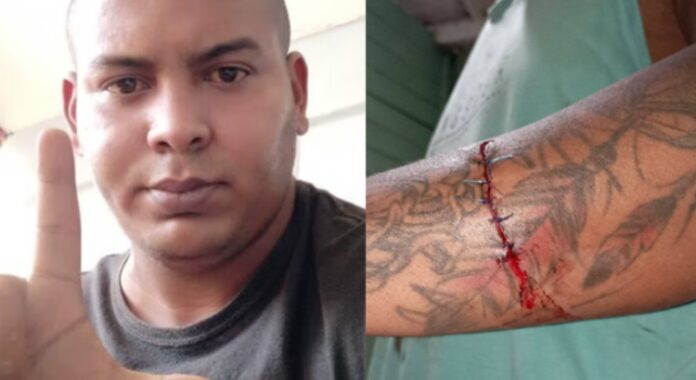 Atacan con arma blanca a activista cubano Alejandro Garlobo