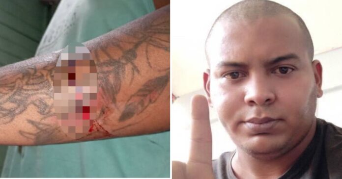 Activista Alejandro Garlobo sufre ataque con arma blanca