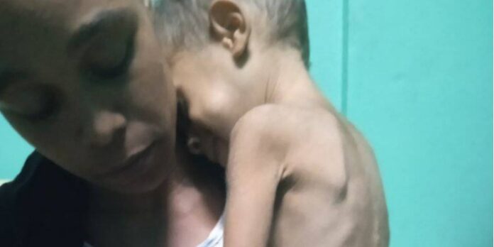 Madre cubana pide ayuda para su niño enfermo y desnutrido